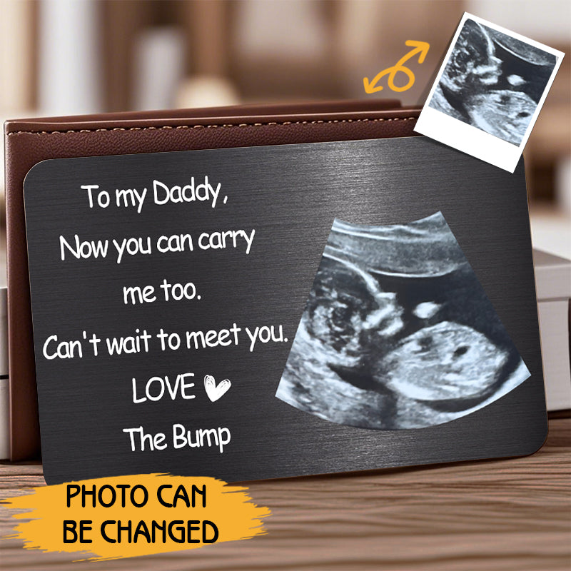 Now You Can Carry Me Too – Personalized Ultrasound Wallet Card – Gift for Expecting Dads