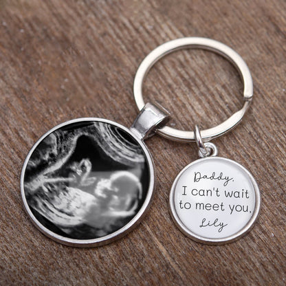Personalized Ultrasound Photo Keychain – Custom Baby Sonogram Keepsake with Engraved Name – Gift for Expecting Parents