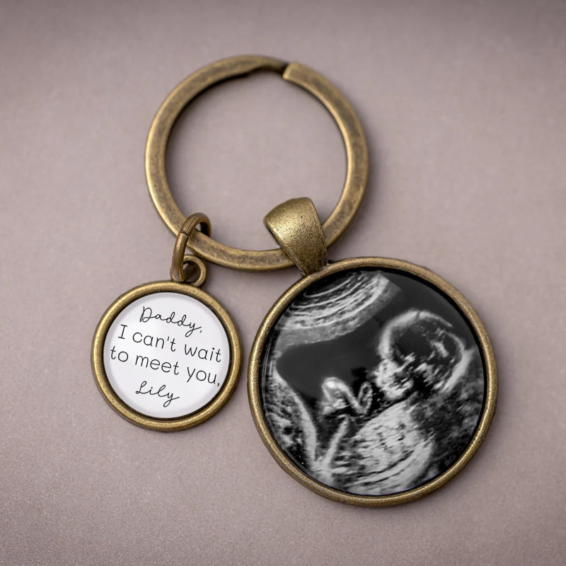 Personalized Ultrasound Photo Keychain – Custom Baby Sonogram Keepsake with Engraved Name – Gift for Expecting Parents