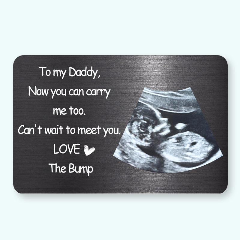 Now You Can Carry Me Too – Personalized Ultrasound Wallet Card – Gift for Expecting Dads