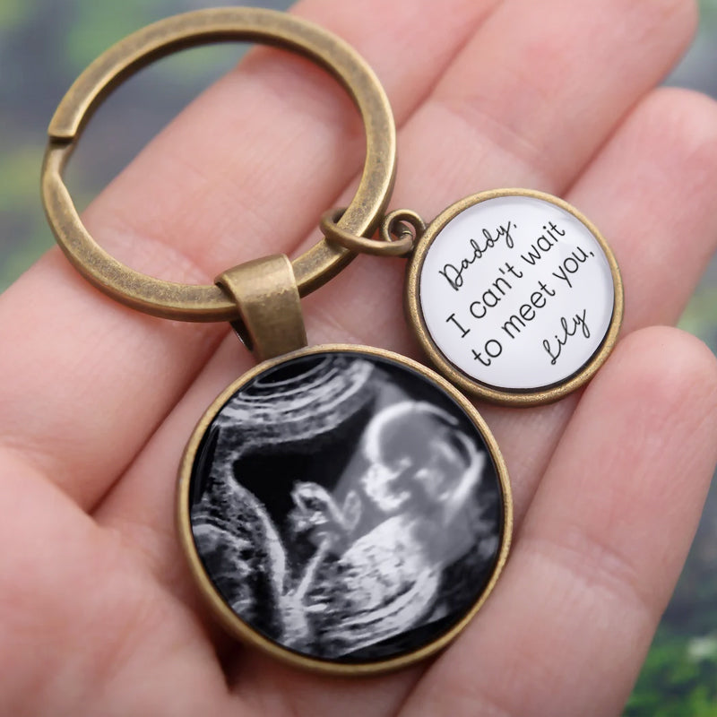 Personalized Ultrasound Photo Keychain – Custom Baby Sonogram Keepsake with Engraved Name – Gift for Expecting Parents