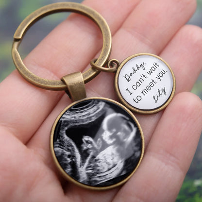 Personalized Ultrasound Photo Keychain – Custom Baby Sonogram Keepsake with Engraved Name – Gift for Expecting Parents