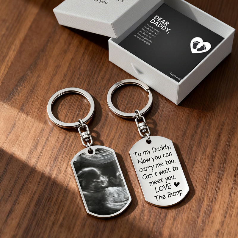 A special keepsake for fathers, this customizable ultrasound keychain lets them hold baby’s first image and a heartfelt note, a touching reminder of the joy of impending parenthood.